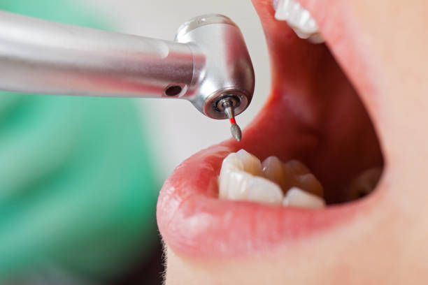 Dentist for Dental Trauma in HI